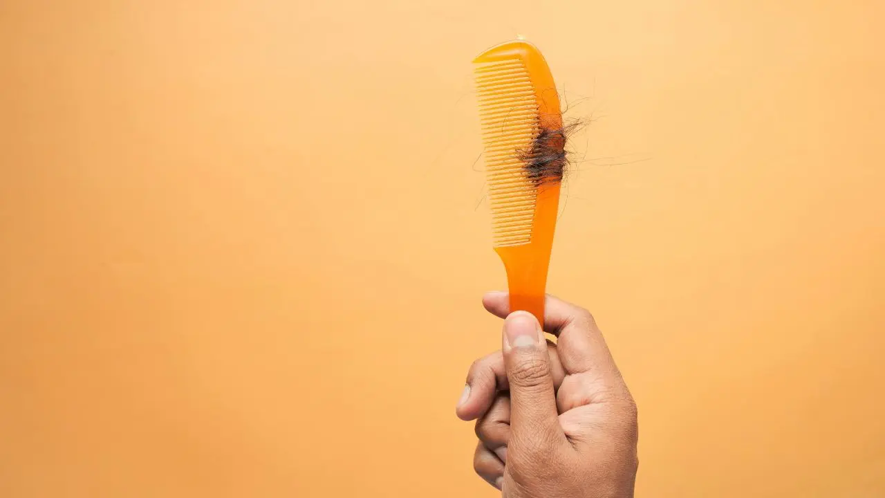 La batalla contra la alopecia: Bogotá abre sus puertas a valoraciones capilares gratuitas