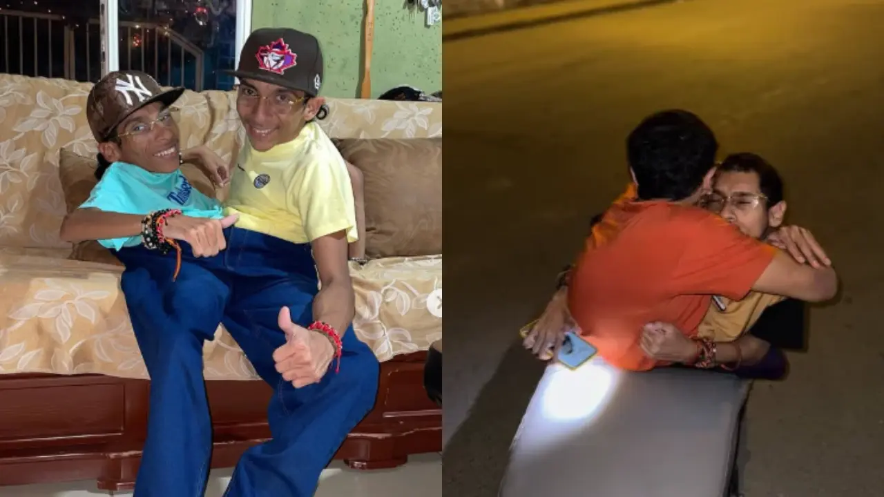 Famosos siameses de Ecuador mueren en Colombia: esto se sabe de su deceso